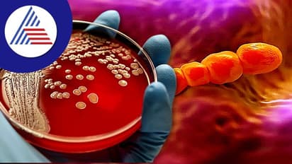 ಮಾರಕ ಕಾಯಿಲೆಗೆ ಕಾರಣವಾಗೋ ಐದು ಬ್ಯಾಕ್ಟಿರೀಯಾ; ಎಲ್ಲೆಲ್ಲಿ ಇರುತ್ತವೆ ತಿಳ್ಕೊಳ್ಳಿ