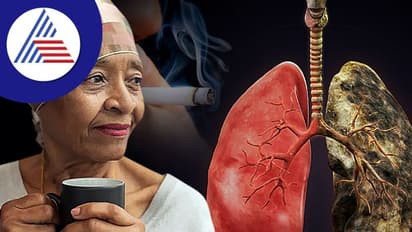 ಧಮ್ ಎಳೆಯದೇ ಹೋದ್ರೂ ಮಹಿಳೆಯರನ್ನು ಹೆಚ್ಚು ಕಾಡ್ತಿದೆ Lung Cancer