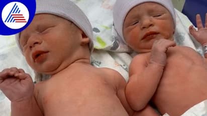 ವೈದ್ಯಲೋಕದ ಅಚ್ಚರಿ: 30 ವರ್ಷದ ಹಿಂದಿನ ಭ್ರೂಣದಿಂದ ಜನಿಸಿದ ಅವಳಿ ಮಕ್ಕಳು