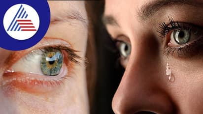 ಅಳೋದು ದೌರ್ಬಲ್ಯದ ಸಂಕೇತವಲ್ಲ, ಕಣ್ಣೀರು ಬರದಿದ್ರೆ ಈ ಕಾಯಿಲೆನೂ ಆಗಿರ್ಬೋದು !