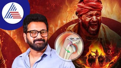 Dislocated Shoulder: 'ಕಾಂತಾರ'ದ ಹೀರೋ ರಿಷಬ್ ಶೆಟ್ಟಿ ಅನುಭವಿಸಿದ ಭುಜದ ಸಮಸ್ಯೆಯೇನು ?