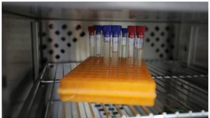 കുവൈത്തില് കോളറ സ്ഥിരീകരിച്ചതായി ആരോഗ്യ മന്ത്രാലയത്തിന്റെ അറിയിപ്പ്