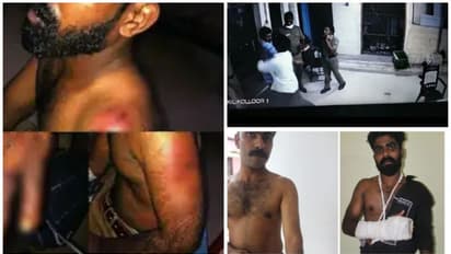 'മർദ്ദനം സ്റ്റേഷനിൽ വെച്ച്, മർദ്ദിച്ചത് ആരാണെന്നറിയില്ല'; കിളികൊല്ലൂർ കേസിൽ പൊലീസിനെ സംരക്ഷിച്ച് റിപ്പോർട്ട്