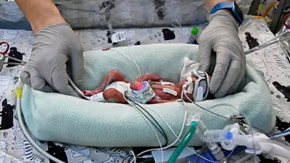 What is premature birth? Do some women have a higher risk of giving birth prematurely?