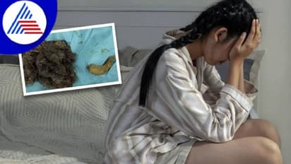 ತಲೆಯ ಕೂದಲನ್ನೇ ಕಿತ್ತು ತಿನ್ತಿದ್ಲು, ಹೊಟ್ಟೆಯಲ್ಲಿದ್ದ ಕೂದಲೆಷ್ಟು ಗೊತ್ತಾ ? 