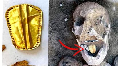 सोने की जीभ वाले कंकाल मिलने से साइंटिस्ट हैरान, इस वजह से असली जीभ काटकर लगा दी जाती थी सोने की