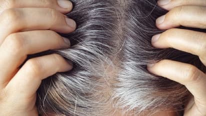 शादी के दो साल बाद सफेद हो गए पत्नी के बाल तो नाराज हुआ पति, रचाने गया दूसरी शादी तो हो गया ये कांड