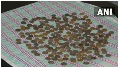 58കാരന്റെ വയറ്റില്‍ നിന്ന് ഡോക്ടര്‍മാര്‍ നീക്കം ചെയ്തത് 187 നാണയങ്ങള്‍