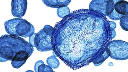 Scientists revive 48,500-year-old 'zombie' virus from Siberian permafrost, is it bad news?