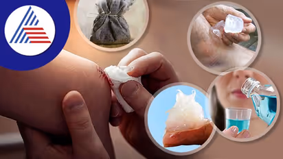Health Tips: ಗಾಯದ ರಕ್ತಸ್ರಾವ ತಡೆಯುತ್ತೆ ಮನೆಯಲ್ಲಿರುವ ಈ ವಸ್ತು