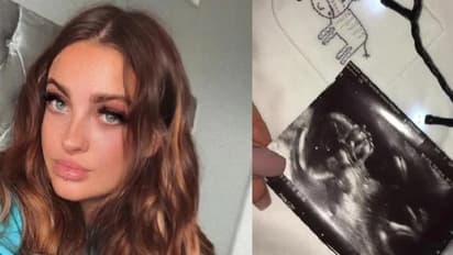 13 साल की उम्र में हुई प्रेग्नेंट,अबॉर्शन कराने की सलाह के बीच बन गई मां, अब शेयर की लाइफ चेंजिंग कहानी