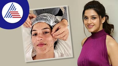 ಅಯ್ಯೋ ಈ ನಟಿಗೆ ಏನಾಯ್ತು..! ಮೆಹ್ರೀನ್ ಕೌರ್ ಮುಖದ ತುಂಬಾ ಸೂಜಿಗಳನ್ನು ನೋಡಿ ಫ್ಯಾನ್ಸ್ ಶಾಕ್