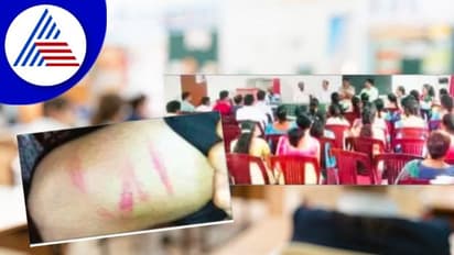 ನಾಲ್ವರು ವಿದ್ಯಾರ್ಥಿಗಳಿಗೆ ಥಳಿತ; ಶಿಕ್ಷಕರ ವಿರುದ್ಧ ಕ್ರಮಕ್ಕೆ ಪೋಷಕರ ಆಗ್ರಹ