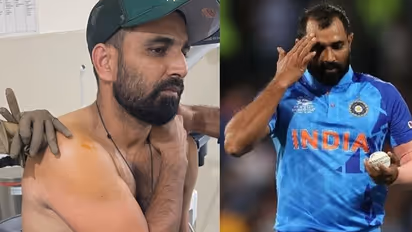 Bangladesh vs India 2022: Injured Shami ruled out of ODIs, Umran Malik to replace him
