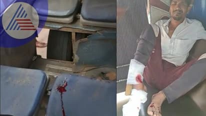 Bengaluru: ಬಿಎಂಟಿಸಿ ಬಸ್ ಟೈರ್‌ ಬ್ಲಾಸ್ಟ್‌ ಪ್ರಯಾಣಿಕನ ಕಾಲಿಗೆ ಗಾಯ