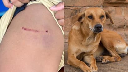 തിരുവനന്തപുരത്ത് 10 വയസുകാരനെ തെരുവുനായ വീടിനുള്ളിൽ കയറി കടിച്ചു