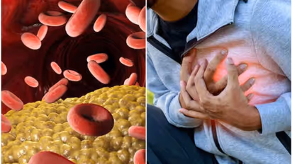 കൊളസ്ട്രോളിനെ എങ്ങനെ നിയന്ത്രിക്കാം? തിരിച്ചറിയണം ഈ അപകടസാധ്യതകൾ...