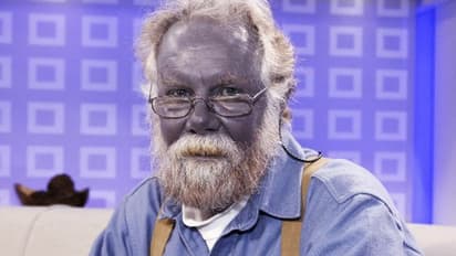 Blue Skin Man : ஊட்டச்சத்து கிடைக்க வேண்டிய ஆசைப்பட்டு முதியவருக்கு நேர்ந்த பரிதாபம்..!!