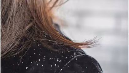 മഞ്ഞുകാലത്തെ തലമുടി സംരക്ഷണം; ഡയറ്റില് ഉള്പ്പെടുത്താം ഈ ഭക്ഷണങ്ങള്...