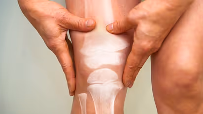 What is Stiff person syndrome? A glance at its causes and symptoms