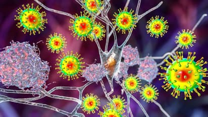 കൊവിഡ് 19 മസ്തിഷ്ക വാർദ്ധക്യത്തിലേക്ക് നയിച്ചേക്കാം : പഠനം 