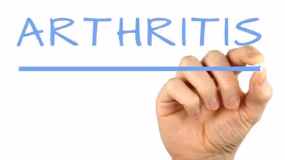 रूमेटाइड आर्थराइटिस की दवा से दिल की बीमारी का खतरा किया जा सकता है कम, स्टडी में खुलासा