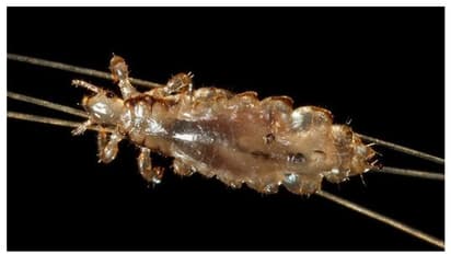 നെടുങ്കണ്ടത്ത് പേനിന്റെ ആക്രമണം; കടിയേറ്റ 30 പേർ ചികിത്സയിൽ