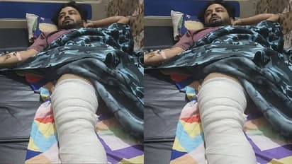 आशिकों को रोकने पर युवक की रॉड व लात-घूसों से की पिटाई, 12 जगह से टूटी हड्डी तो पुलिस ने ऐसे झाड़ा पल्ला