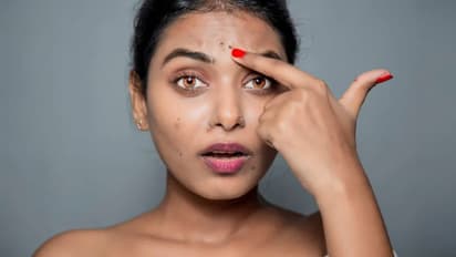 മുഖത്തെ കറുത്ത പാടുകള്‍ അകറ്റാന്‍ അടുക്കളയിലുള്ള ഈ നാല് വസ്തുക്കള്‍ ഇങ്ങനെ ഉപയോഗിക്കാം...