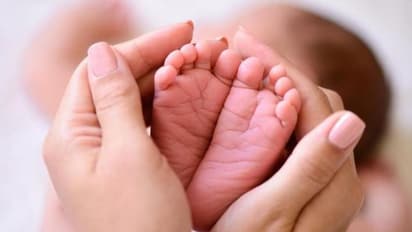 அதிசயம்.!! நான்கு கால்களுடன் பிறந்த குழந்தை.. வைரலாகும் போட்டோஸ் !