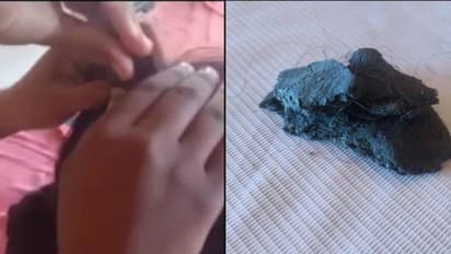 ಪೊಲೀಸ್ ಕೆಲಸ ಗಿಟ್ಟಿಸಿಕೊಳ್ಳಲು ತಲೆಗೆ M-seal ಅಂಟಿಸಿದ ನಾರಿ