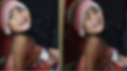 ढाई साल की बर्न रोगी बेटी को 4 अस्पताल लेकर भटकता रहा पिता, दर्द से कराहती रही बच्ची मगर डॉक्टर देखने नहीं आए