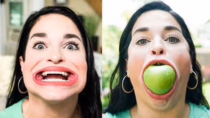 Largest Mouth Gap : ये है दुनिया में सबसे चौड़े मुंह वाली महिला, एक बार में निगल जाती है पूरा बर्गर