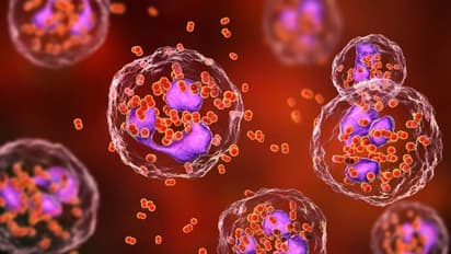 உடலில் இந்த அறிகுறிகள் இருக்கிறதா.. பாலியல் தொற்றுக்களில் இருந்து தப்பிப்பது எப்படி ?