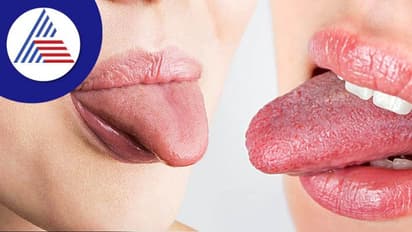 நாக்கில் மச்சம் இருந்தால் சொல்வது பலிக்குமா? சாமுத்திரிகா சாஸ்திரம் கூறுவது என்ன?