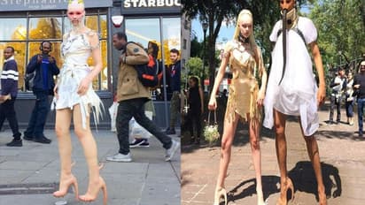 जानवर नहीं अब इंसान की स्किन से बन रहे हैं फैशन प्रोडक्ट, 11 लाख का पर्स तो 22 लाख है जूते की कीमत