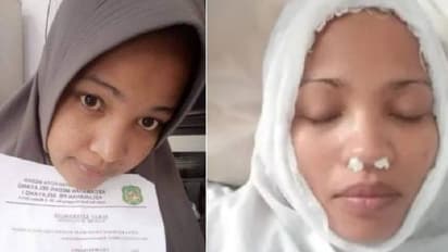 ಸಾಲಗಾರರಿಂದ  ತಪ್ಪಿಸಿಕೊಳ್ಳಲು ಮೂಗಿಗೆ ಹತ್ತಿ ಇಟ್ಟು ಫೇಸ್‌ಬುಕ್‌ಗೆ ಫೋಟೋ ಹಾಕಿದ ಮಹಿಳೆ