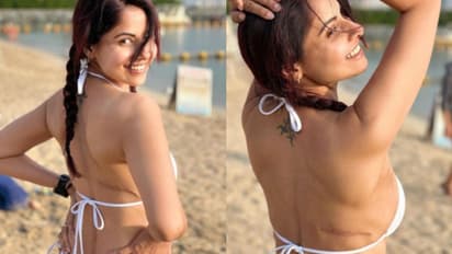 സ്തനാര്‍ബുദം സമ്മാനിച്ച മുറിപ്പാടുകള്‍; ചിത്രങ്ങള്‍ പങ്കുവച്ച് നടി