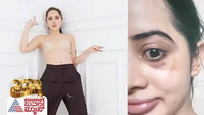 ಕಿರುತೆರೆ ನಟಿ ಉರ್ಫಿ ಜಾವೇದ್ ಮೂತಿ ಮುಸುಡಿ ಊಸ್ಟ್‌; ಫೋಟೋ ವೈರಲ್