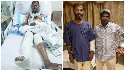 പരിക്കേറ്റ് നാട്ടിലേക്ക് പുറപ്പെടാനെത്തിയ പ്രവാസിയെ എയര്പോർട്ടിന് മുന്നിൽ വെച്ച് വാഹനമിടിച്ച് ഗുരുതര പരിക്ക്