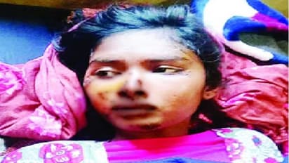 'मुझे नहीं पता कब रुकी गाड़ी' कौशांबी में भी दिल्ली जैसी घटना, कार में फंसकर 200 मीटर तक घिसटी छात्रा