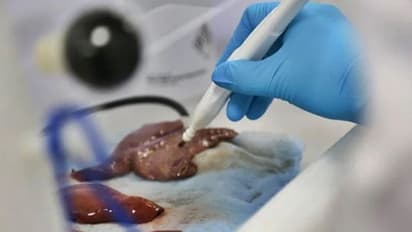 आ गया चमत्कारी सर्जिकल चाकू, जो ट्यूमर को 'सूंघकर' सेकंडों में कैंसर का लगाएगी पता