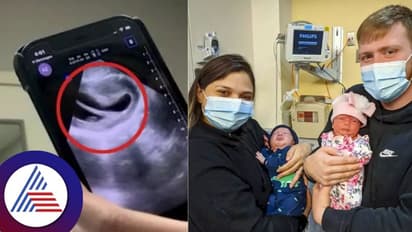 ಅರೆ, ಇದೆಂಥಾ ವಿಚಿತ್ರ..ಹಾರ್ಟ್ ಶೇಪ್‌ನಲ್ಲಿದೆ ಮಹಿಳೆಯ ಗರ್ಭಕೋಶ!