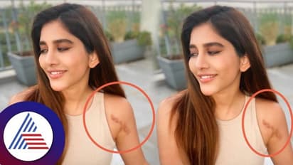 ಭೀಕರ ಅಪಘಾತದಿಂದ ಮೂರ್ನಾಲ್ಕು ಅಪರೇಷನ್ಗೆ ಒಳಗಾದ ನಟಿ ನಭಾ ನಟೇಶ್