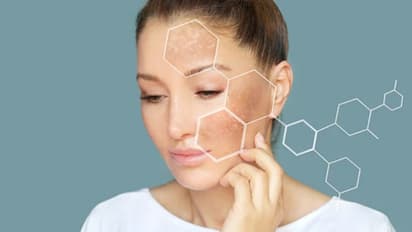 മുഖത്തെ ചുളിവുകൾ, കറുത്ത പാടുകൾ; വീട്ടില്‍ പരീക്ഷിക്കാം ഇക്കാര്യങ്ങള്‍...