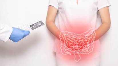 കുടൽ കാൻസർ ; തുടക്കത്തിൽ കാണുന്ന ഈ ലക്ഷണങ്ങൾ നിസാരമാക്കരുത് 