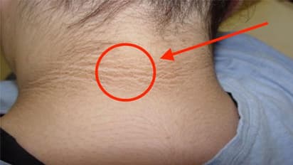 കഴുത്തിലെ കറുത്ത പാടുകള് അകറ്റാം; വീട്ടില് പരീക്ഷിക്കാം ഇക്കാര്യങ്ങള്...