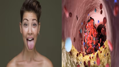 जीभ का यह रंग हाई कोलस्ट्रॉल का देता है संकेत, गंभीर बीमारी का शिकार होने से पहले हो जाएं अलर्ट