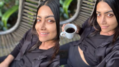  'എനിക്ക് നിറം നഷ്‌ടപ്പെടുന്നു'; രോ​ഗാവസ്ഥ പങ്കുവച്ച് മംമ്ത മോഹൻദാസ്