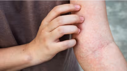 ശരീരത്തിലെ ചൊറിച്ചില്‍ അവഗണിക്കരുത്; ആരംഭത്തിൽ തന്നെ ഈ രോഗലക്ഷണങ്ങൾ തിരിച്ചറിയാം